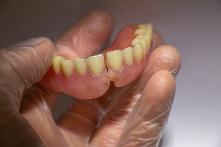5 signs that your dentures need to be replaced